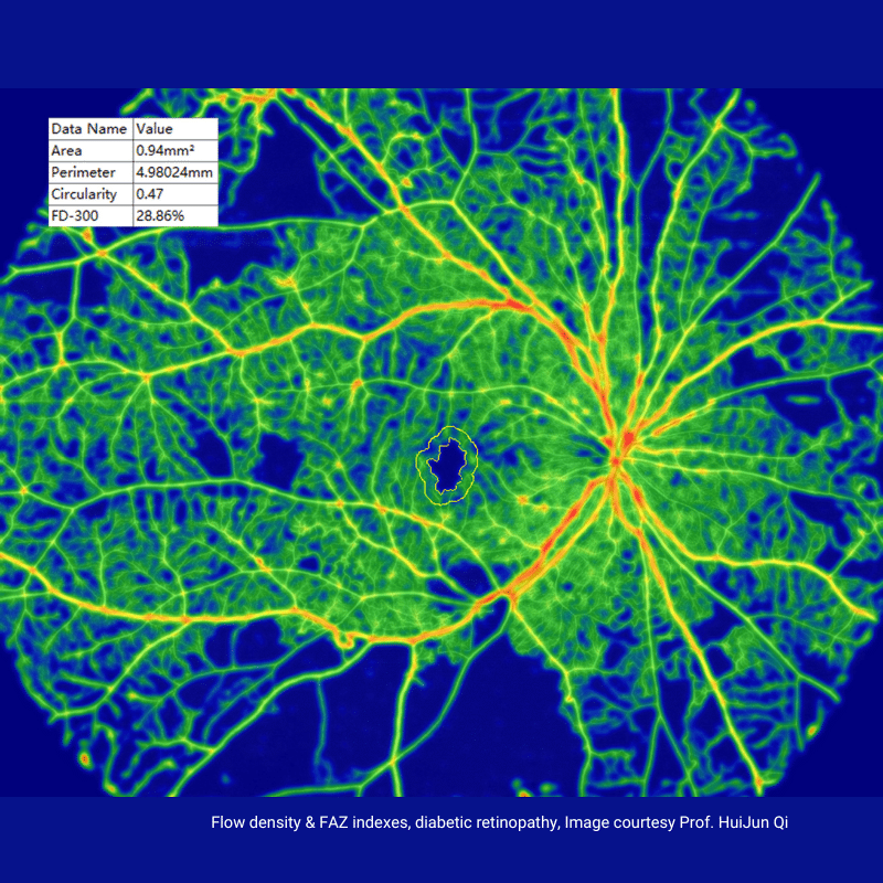 TowardPi - BMizar 400KHz Full-Range SS-OCT - Mainline